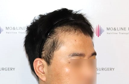 치료후기 이미지